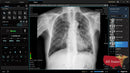 Digital X-Ray XR-5 Premium-X-Ray-All States M.E.D.