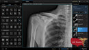 Digital X-Ray XR-5 Premium-X-Ray-All States M.E.D.
