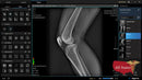 Digital X-Ray XR-5 Premium-X-Ray-All States M.E.D.