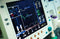 EKG & ECG Buyers Guide: Tips for Finding the Right One