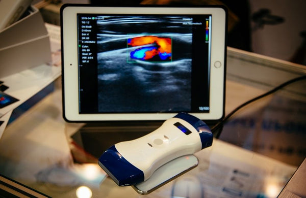 Top 3 Advantages of Portable Ultrasound Machines