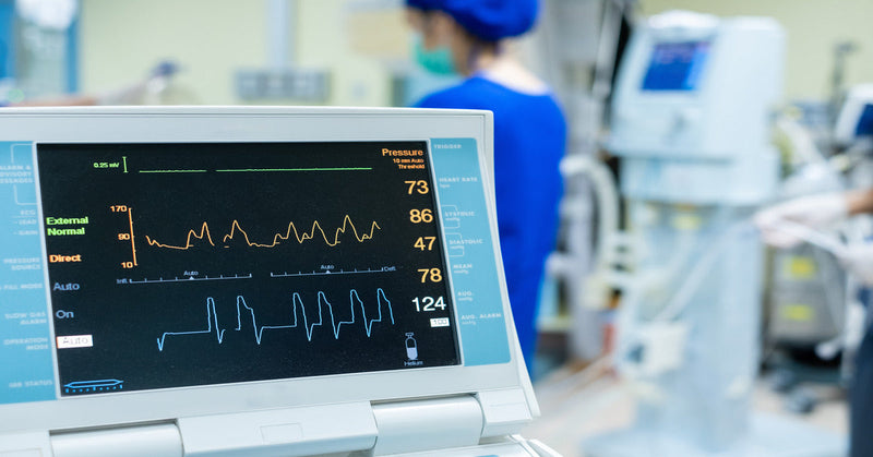 An EKG monitor displays heart activity in a medical office, with a doctor standing in the background.