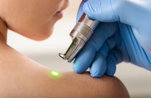 A gloved hand is holding a medical laser. The device emits a small green circle on a person's bare shoulder.