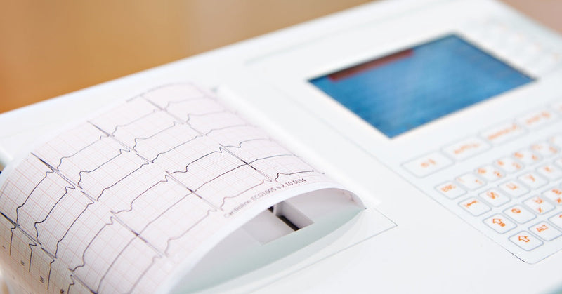 A small portable ECG machine displays digital results on its screen and prints them onto white paper.