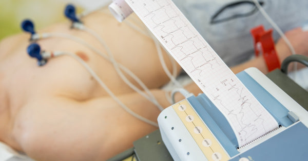 A patient with electrocardiogram electrodes attached to his chest. Someone is holding the paper the ECG machine is printing on.
