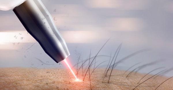 At close range, a silver laser has a red beam shooting out of the tip. The beam is targeted at a hair follicle.