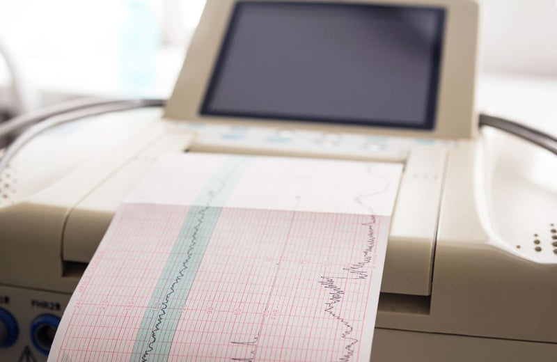 Ecg Machine Using Everything You Should Know About Using EKG Machines