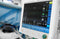Essential Guide to Buying a Vital Signs Monitor