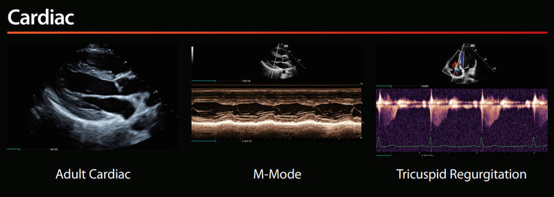 Mindray MX7 Ultrasound OBGYN Package 2 Probes (With Cart)