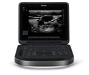 Sonosite EDGE 2 Ultrasound with Linear Probe-Ultrasounds-All States M.E.D.