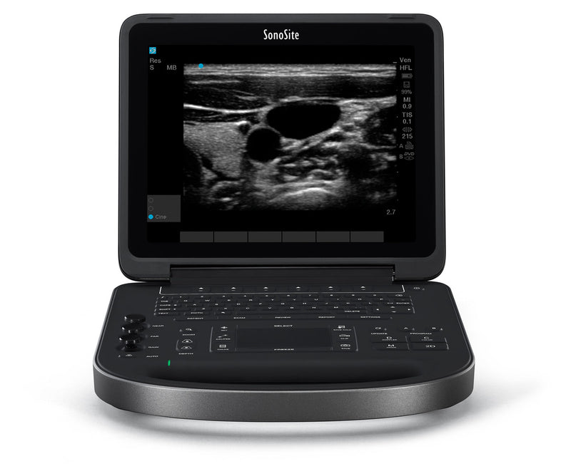 Sonosite EDGE 2 Ultrasound with Linear Probe-Ultrasounds-All States M.E.D.