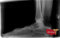 2020 Digital Plate Digital Podiatry Xray With Xcel Xray Platform-X-Ray-All States M.E.D.