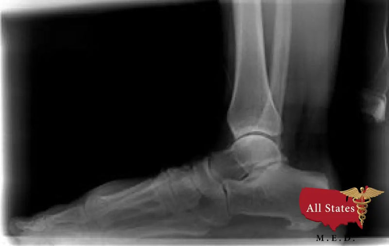 2020 Digital Plate Digital Podiatry Xray With Xcel Xray Platform-X-Ray-All States M.E.D.