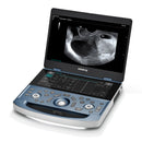 Mindray MX7 Ultrasound OBGYN Package 2 Probes (With Cart)