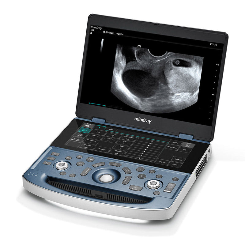 Mindray MX7 Ultrasound OBGYN Package 2 Probes (With Cart)