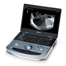 Mindray MX7 Ultrasound VASCULAR PACKAGE 1 Probe