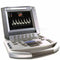 Sonosite titan  Ultrasound