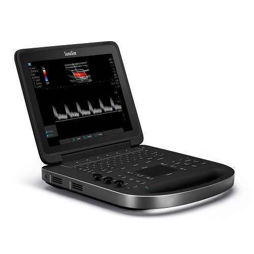 Sonosite EDGE 2 Ultrasound with Linear Probe-Ultrasounds-All States M.E.D.
