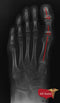 2020 Digital Plate Digital Podiatry Xray With Xcel Xray Platform-X-Ray-All States M.E.D.