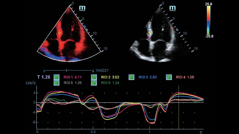 Mindray DC-70 FULL HD Ultrasound