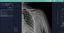 Hand Held Digital X-ray Europa 85 With DR Panel Package Xray
