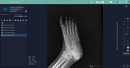 Hand Held Digital X-ray Europa 85 With DR Panel Package Xray