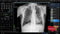 Digital X-Ray XR-5 Premium-X-Ray-All States M.E.D.