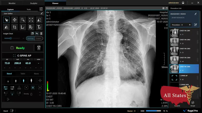 Digital X-Ray XR-5 Premium-X-Ray-All States M.E.D.