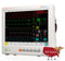 Edan iM80 Patient Monitor-Medical Monitor-All States M.E.D.