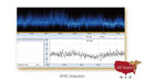 Edan SE 2003 / 2012 Holter monitor-Holter-All States M.E.D.