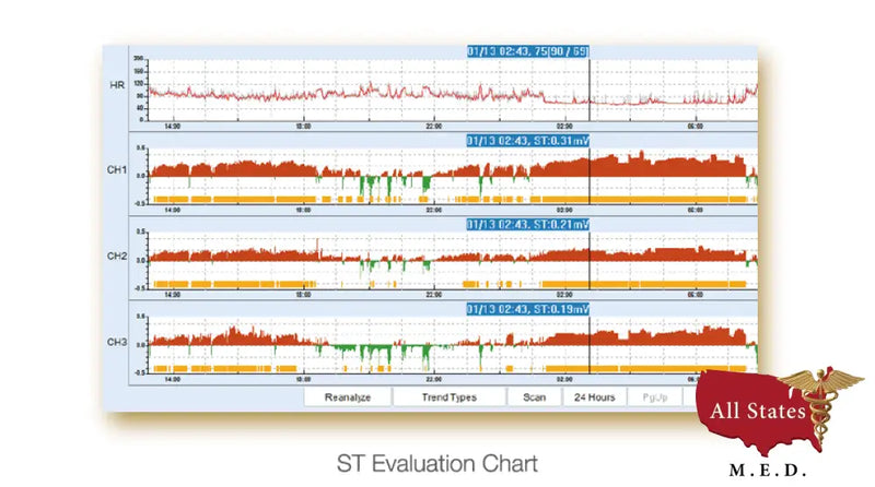 Edan SE 2003 / 2012 Holter monitor-Holter-All States M.E.D.