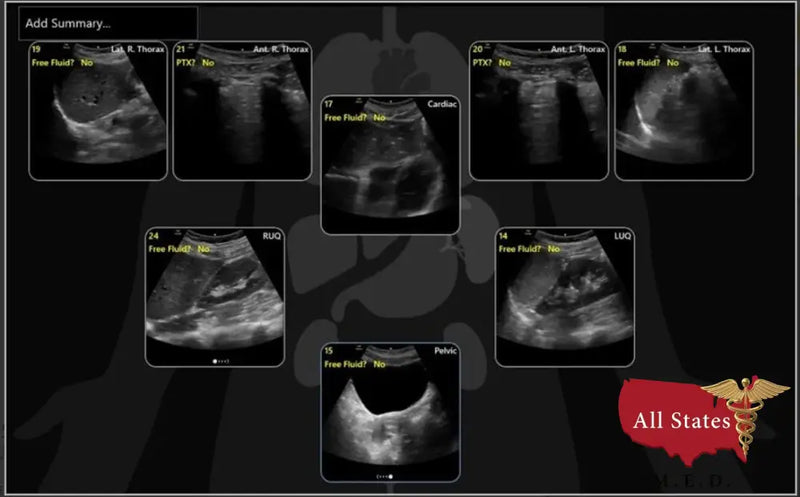 Brand New GE Venue Go R6 Ultrasound