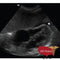 GE Vivid E9 XDClear Refurbished with 3 Probes-Ultrasounds-All States M.E.D.