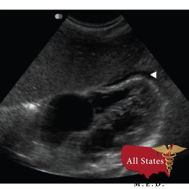 GE Vivid E9 XDClear Refurbished with 3 Probes-Ultrasounds-All States M.E.D.