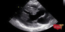 GE Vivid E9 XDClear Refurbished with 3 Probes-Ultrasounds-All States M.E.D.