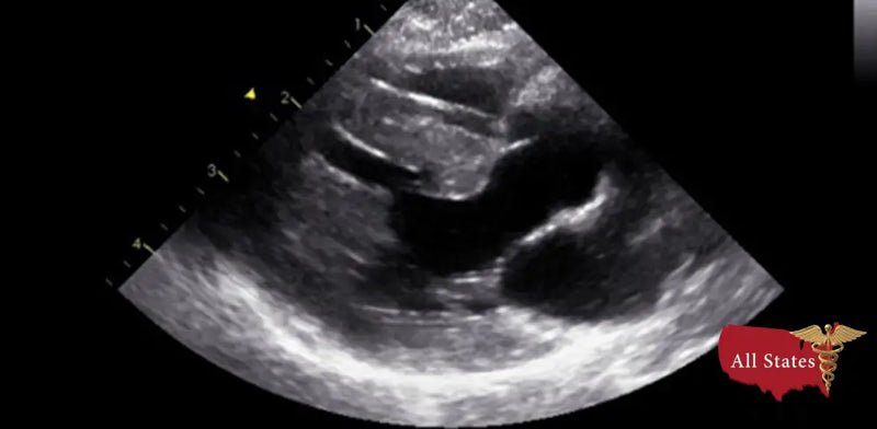 GE Vivid E9 XDClear Refurbished with 3 Probes-Ultrasounds-All States M.E.D.