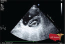 GE Vivid E9 XDClear Refurbished with 3 Probes-Ultrasounds-All States M.E.D.