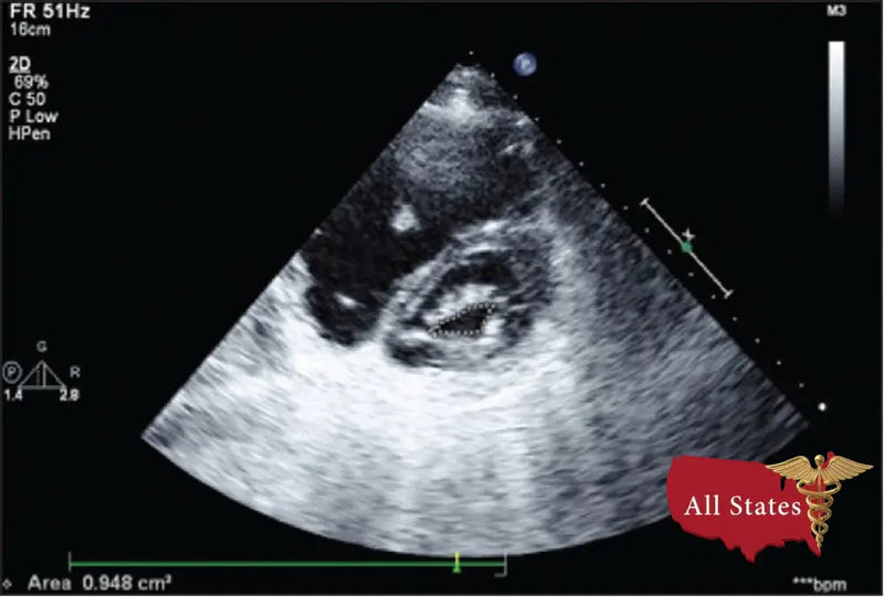 GE Vivid E9 XDClear Refurbished with 3 Probes-Ultrasounds-All States M.E.D.
