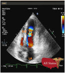 GE Vivid E9 XDClear Refurbished with 3 Probes-Ultrasounds-All States M.E.D.