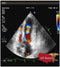 GE Vivid E9 XDClear Refurbished with 3 Probes-Ultrasounds-All States M.E.D.