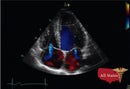 GE Vivid E9 XDClear Refurbished with 3 Probes-Ultrasounds-All States M.E.D.