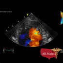 GE Vivid E9 XDClear Refurbished with 3 Probes-Ultrasounds-All States M.E.D.