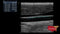 GE VIVID IQ Refurbished with 2 Probes-Ultrasounds-All States M.E.D.
