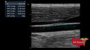 GE Vivid IQ Ultra Edition Portable Ultrasound-Ultrasounds-All States M.E.D.