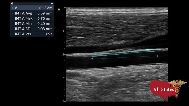 GE Vivid IQ Ultra Edition Portable Ultrasound-Ultrasounds-All States M.E.D.
