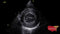 GE Vivid IQ Ultra Edition Portable Ultrasound-Ultrasounds-All States M.E.D.