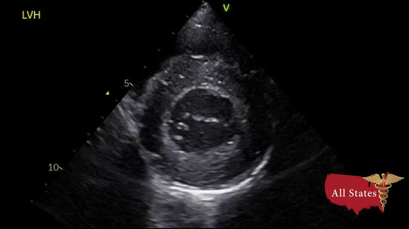 GE Vivid IQ Ultra Edition Portable Ultrasound-Ultrasounds-All States M.E.D.