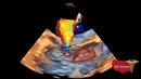 GE Vivid IQ Ultra Edition Portable Ultrasound-Ultrasounds-All States M.E.D.