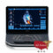 GE Vivid IQ Ultra Edition Portable Ultrasound-Ultrasounds-All States M.E.D.