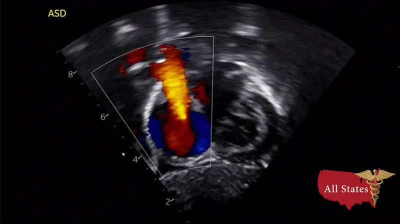 GE Vivid IQ Ultra Edition Portable Ultrasound-Ultrasounds-All States M.E.D.